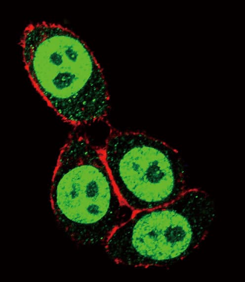 Polyclonal Rabbit anti-Human SMAD3 Antibody (aa186-215, IHC, IF, WB)