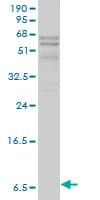 Apolipoprotein C-I Antibody (clone 2E2-1A3)