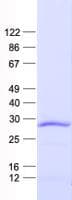 Human SPIC Protein (Recombinant His, N-Terminal)