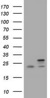 NDUFB10 Antibody (clone OTI4D1)