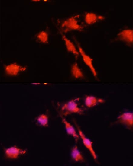 BDNF Antibody