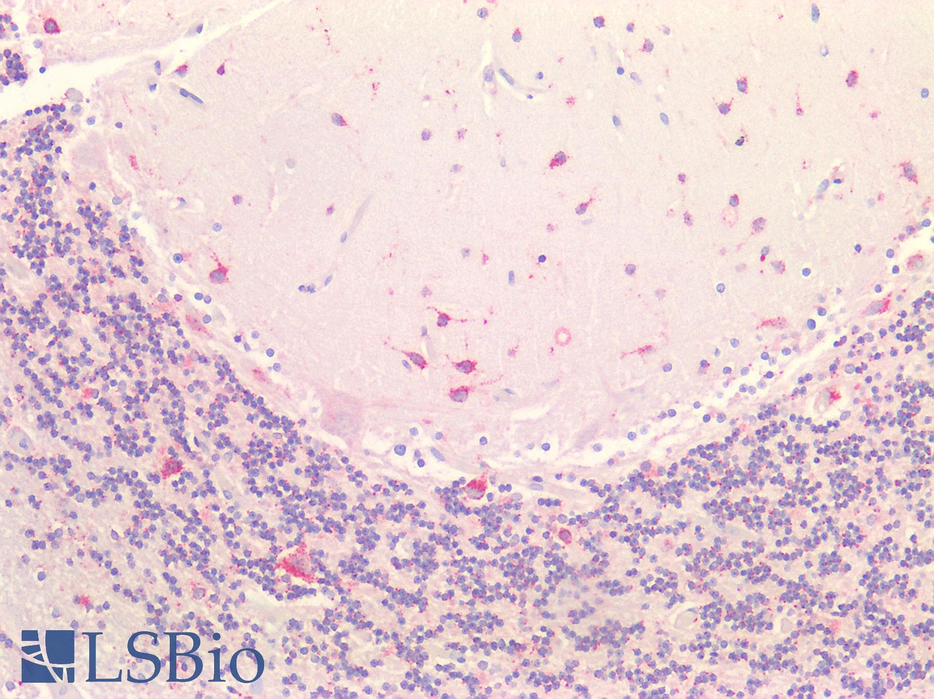 IHC-plus™ Polyclonal Rabbit anti-Human EPDR / EPDR1 Antibody (IHC, WB)