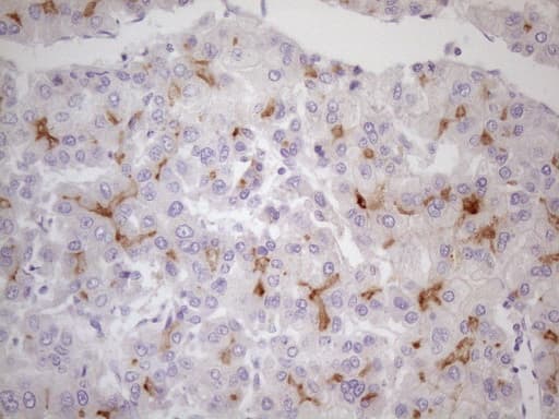TNFRSF18 / GITR Antibody (aa26-162, clone UMAB203)