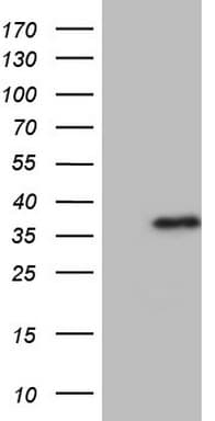 ASPA Antibody (aa77-313, clone OTI5B8)