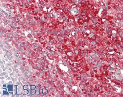 CFB / Complement Factor B Antibody (aa270-388)