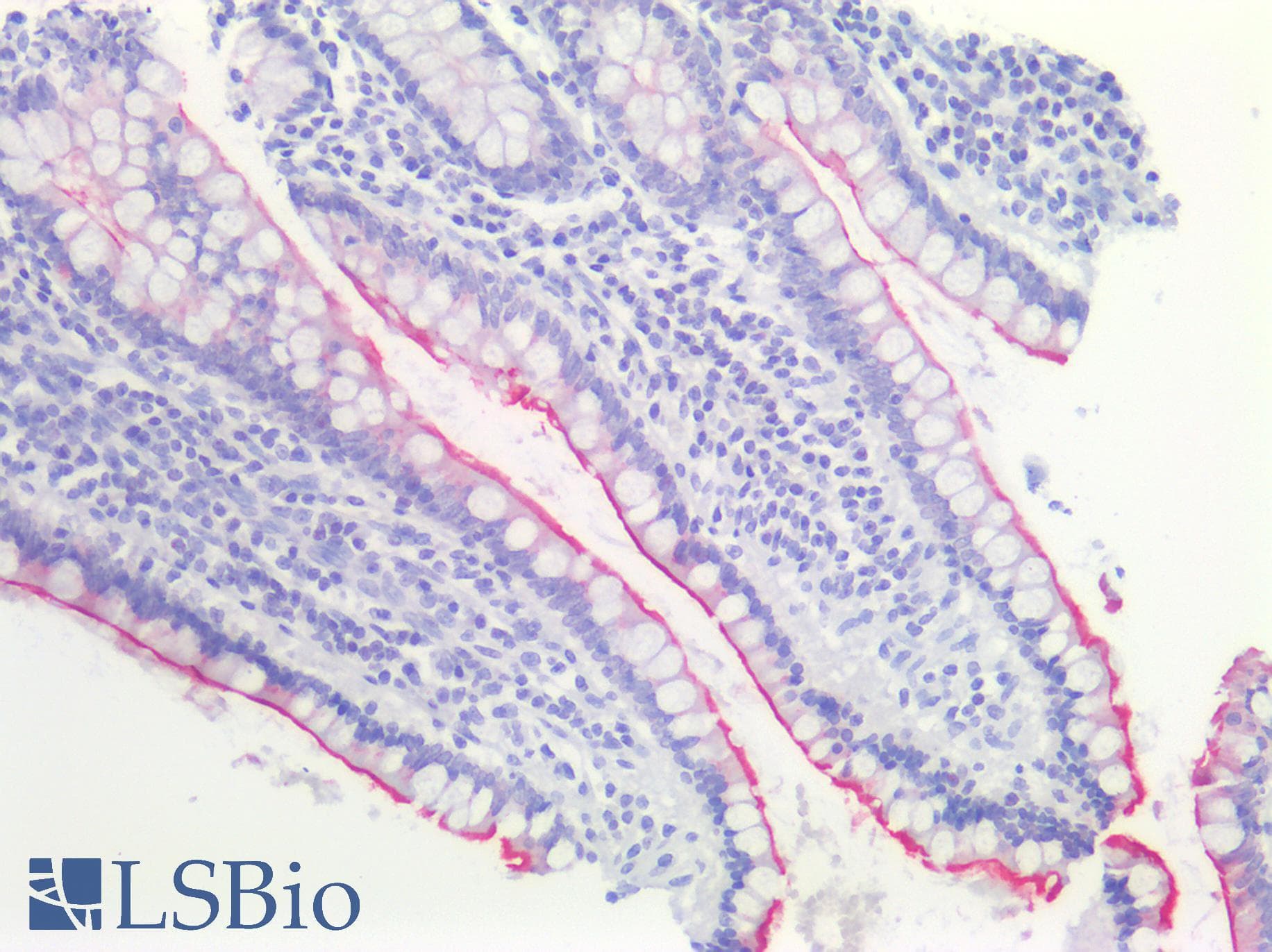Monoclonal Mouse anti-Human ACE2 / ACE-2 Antibody (clone AC18F, IHC, WB)