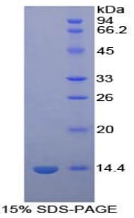 Human CXCL4 / PF4 Protein (Recombinant His, N-Terminal)