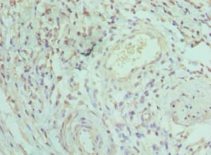Polyclonal Rabbit anti-Human IRAK3 / IRAKM / IRAK-M Antibody (aa367-596, IHC)