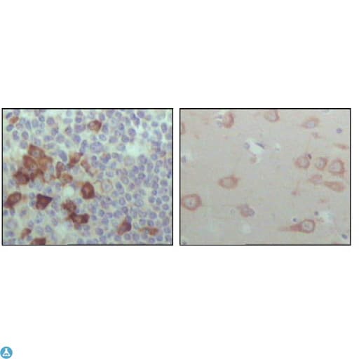 EPHB6 / EPH Receptor B6 Antibody