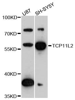TCP11L2 Antibody