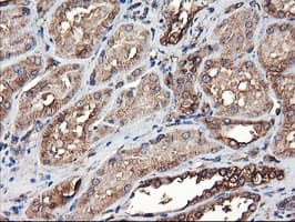 TUBAL3 Antibody (clone OTI4C5)