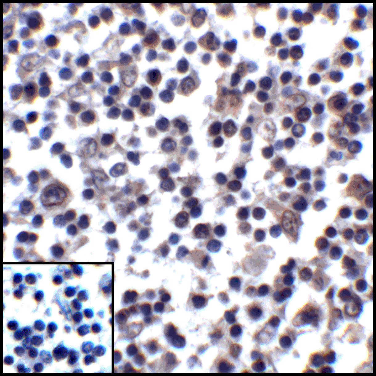 CD274 / B7-H1 / PD-L1 Antibody (clone 1D7)