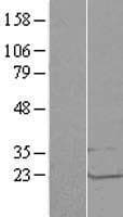 LSM1 Protein (Over-Expression Lysate Myc-DDK (Flag))