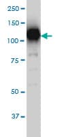 IHC-plus™ SIRT1 / Sirtuin 1 Antibody (clone 7B7)
