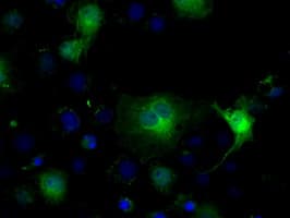 IDH1 / IDH Antibody (clone OTI2H9)