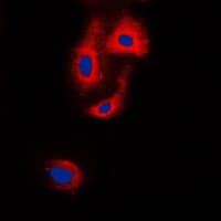 Polyclonal Rabbit anti-Human VASP Antibody (Internal, IHC, IF, WB)