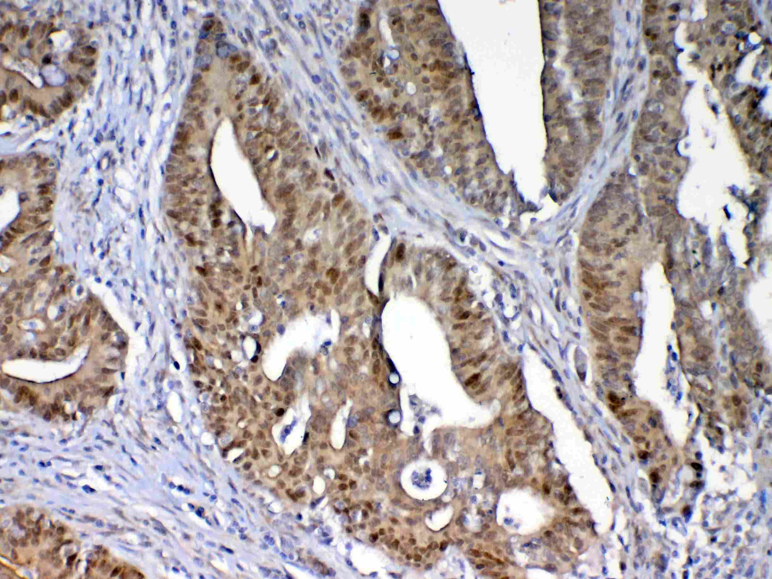 DNMT / DNMT1 Antibody