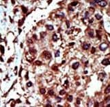 DGK-IOTA / DGKI Antibody (aa890-920)