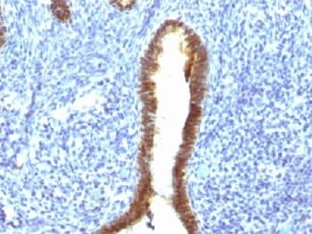 ASRGL1 Antibody (clone CRASH/1289)