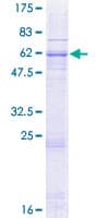 Human SLC25A14 / UCP5 Protein (Recombinant GST)