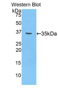 CSPG4 / NG2 Antibody (aa1135-1444)