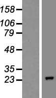 COMMD10 Protein (Over-Expression Lysate Myc-DDK (Flag))