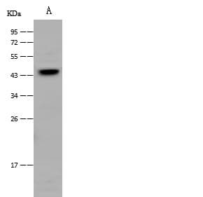 CD1E Antibody (Preservative Free)