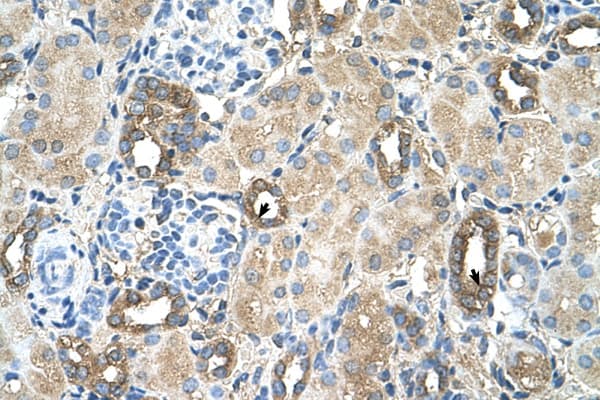 MGAT2 Antibody (aa201-250)