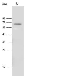 ALAS2 Antibody