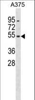DUSP10 / MKP5 Antibody (aa204-232)