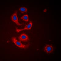 CALR / Calreticulin Antibody (N-Terminus)