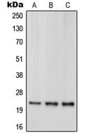 Polyclonal Rabbit anti-Human PARK7 / DJ-1 Antibody (Internal, IHC, IF, WB)
