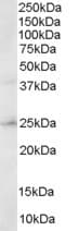 IHC-plus™ HSD17B10 / HADH2 Antibody (aa242-252)