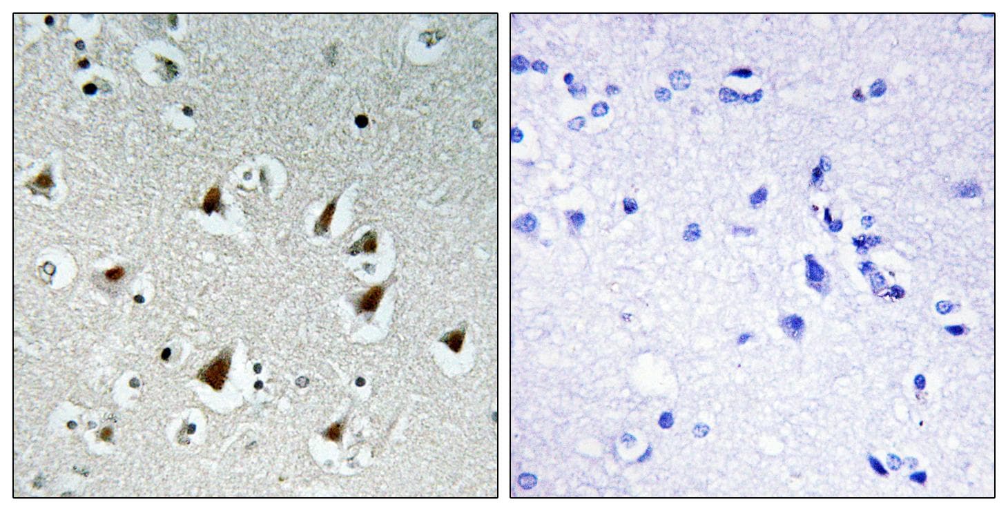 ZHX2 / RAF Antibody
