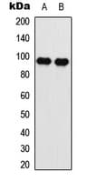 EEF2 / Elongation Factor 2 Antibody (N-Terminus)