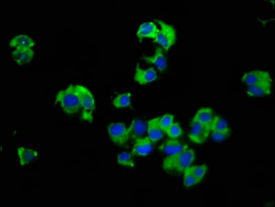 SLC14A1 / JK Antibody