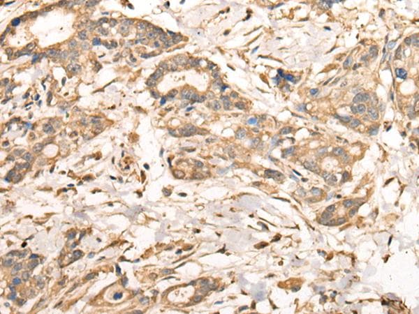 Polyclonal Rabbit anti-Human VTI1A Antibody (IHC, WB)