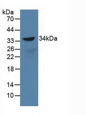SOX18 Antibody (aa153-377, PE)