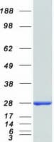 Human CDKN2D / p19 INK4d Protein (Recombinant Myc-DDK (Flag))