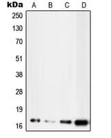 UBE2D2 / UBCH5B Antibody (C-Terminus)