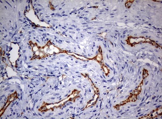 PECAM-1 / CD31 Antibody (clone UMAB31, Carrier-free)