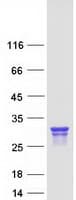 Human CTMP / THEM4 Protein (Recombinant Myc-DDK (Flag))