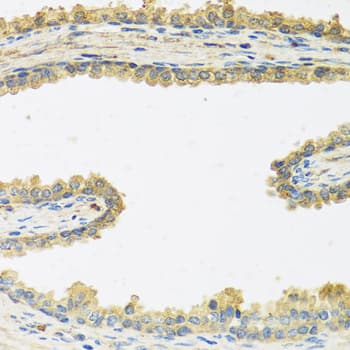 IHC-plus™ Polyclonal Rabbit anti-Human CRHBP Antibody (IHC, IF, WB)