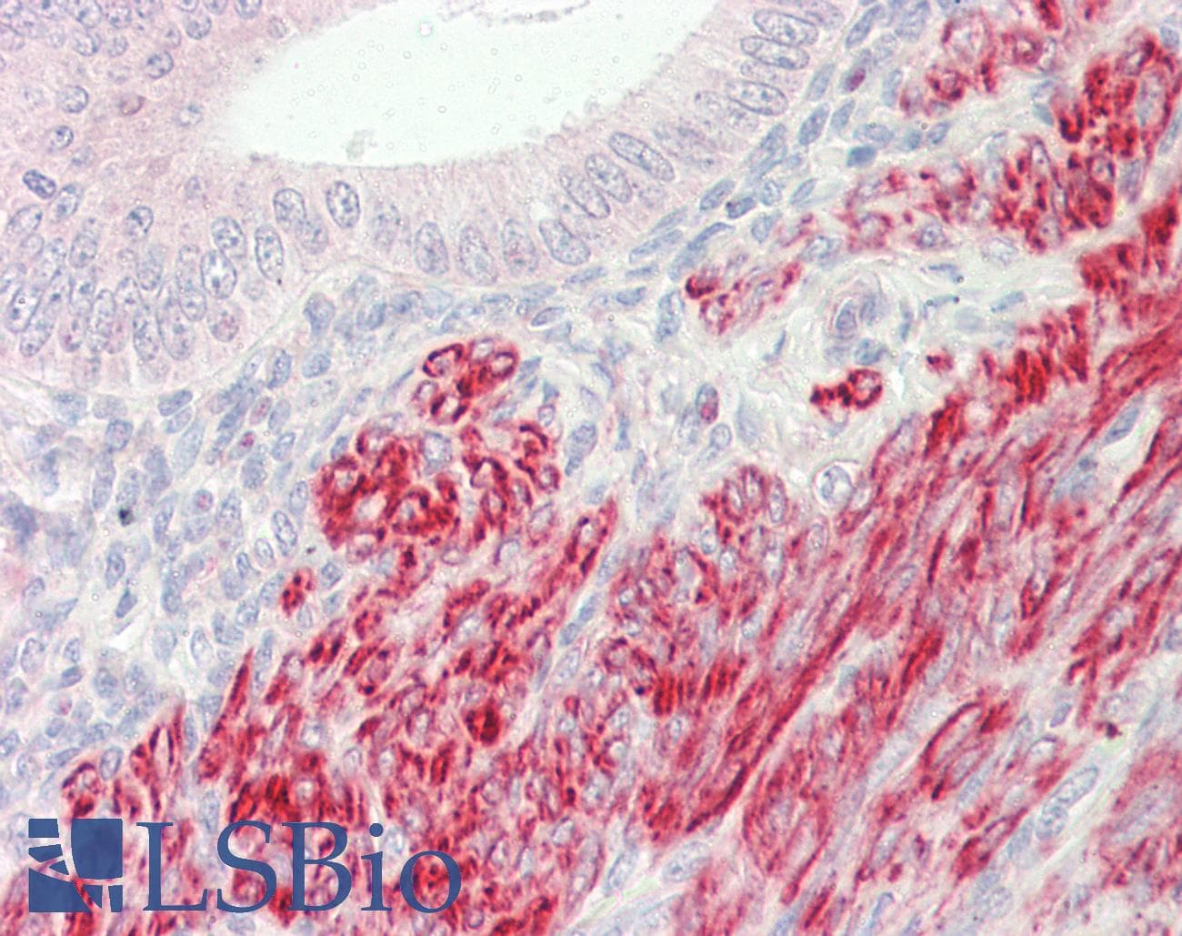 IHC-plus™ INPP5K / SKIP Antibody (aa183-430)