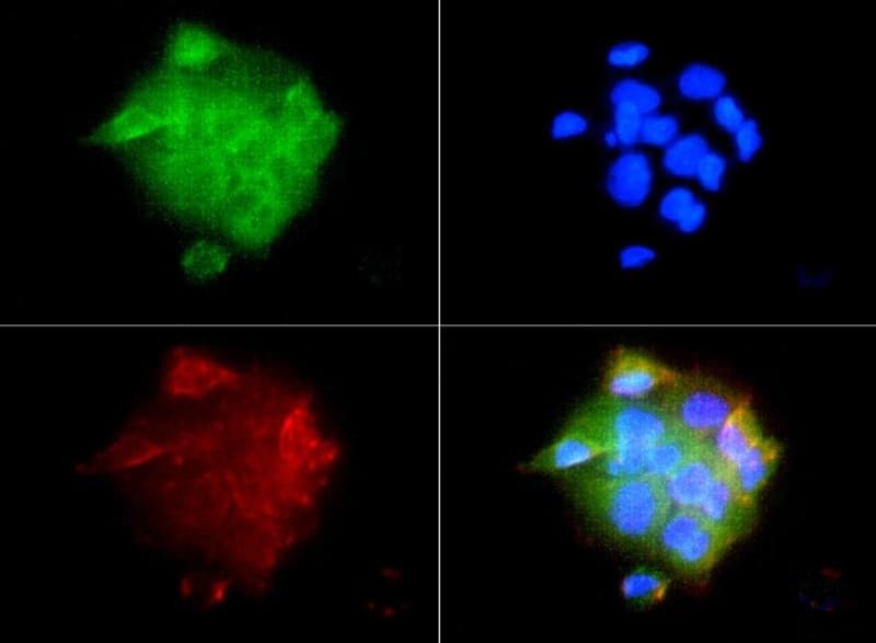 IGF1R / IGF1 Receptor Antibody (DY488)