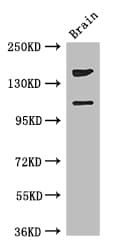 Polyclonal Rabbit anti-Human DEPDC2 Antibody (IHC, IF, WB)