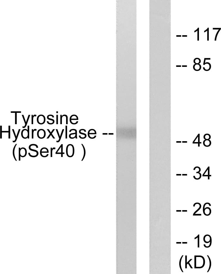 Polyclonal Rabbit anti-Human TH / Tyrosine Hydroxylase Antibody (phospho-Ser40, IHC, WB)