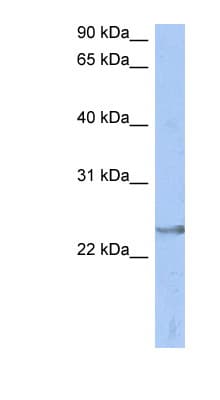 ATP6V1E2 Antibody (aa71-120)