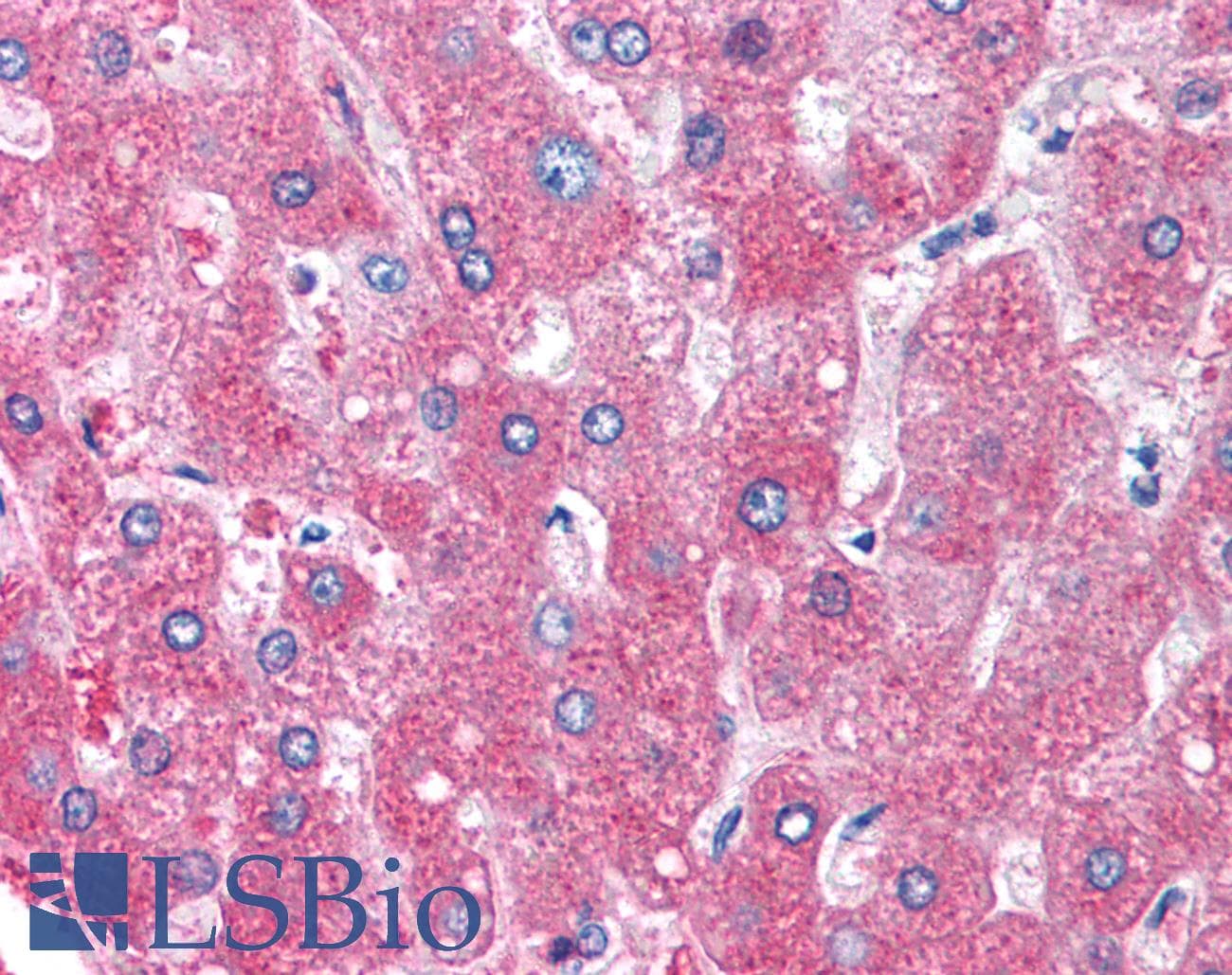 IHC-plus™ SERPINA1 / Alpha 1 Antitrypsin Antibody