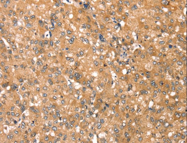RPS6KA1 / RSK1 Antibody